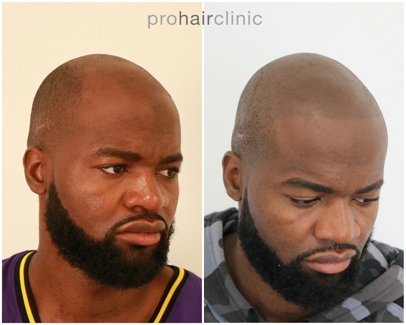 /foren/transplant/index.php/fa/47318/0/