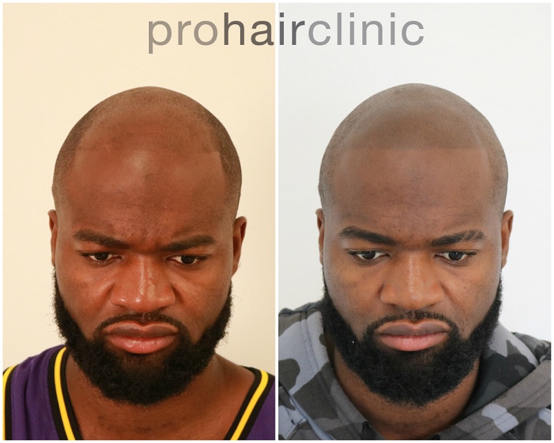 /foren/transplant/index.php/fa/47319/0/