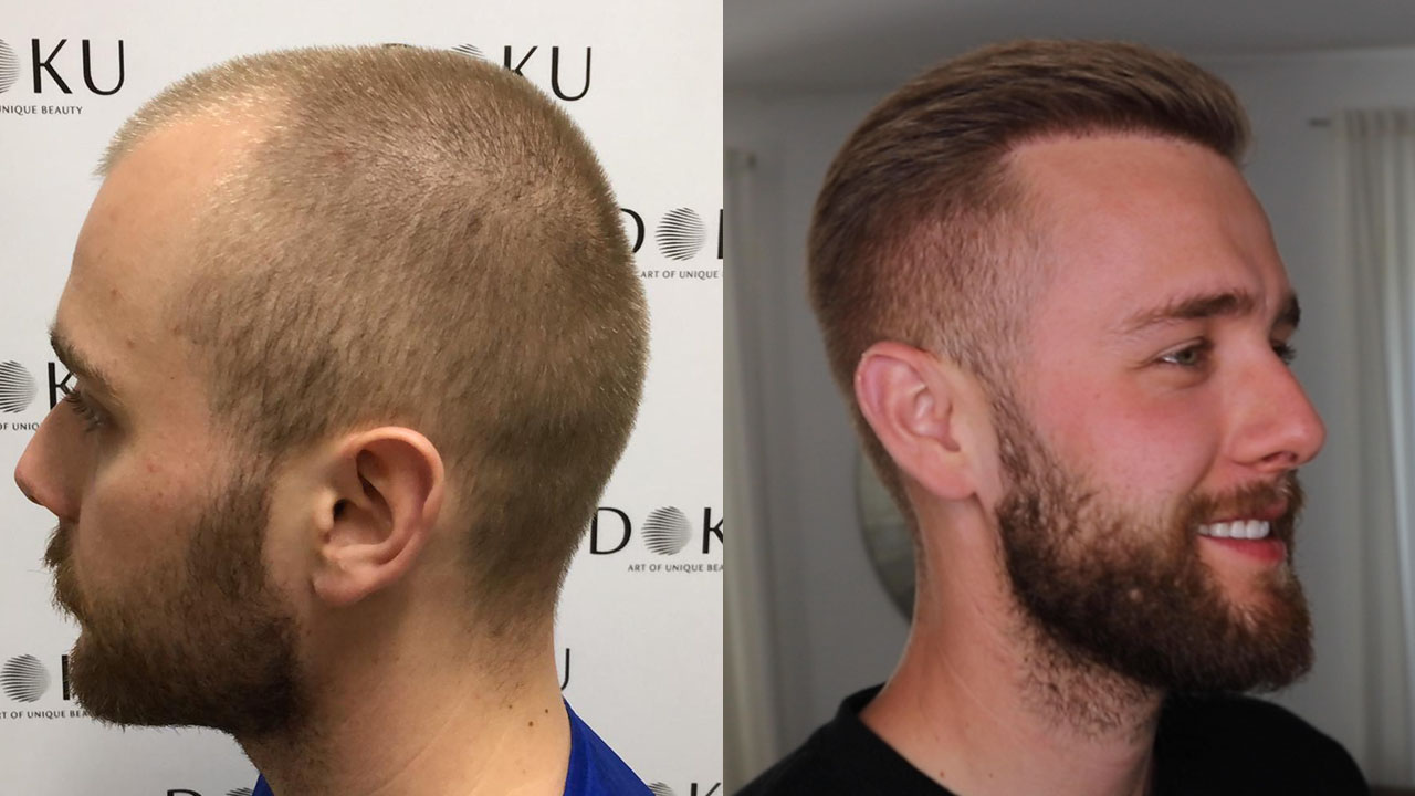 /foren/transplant/index.php/fa/47320/0/