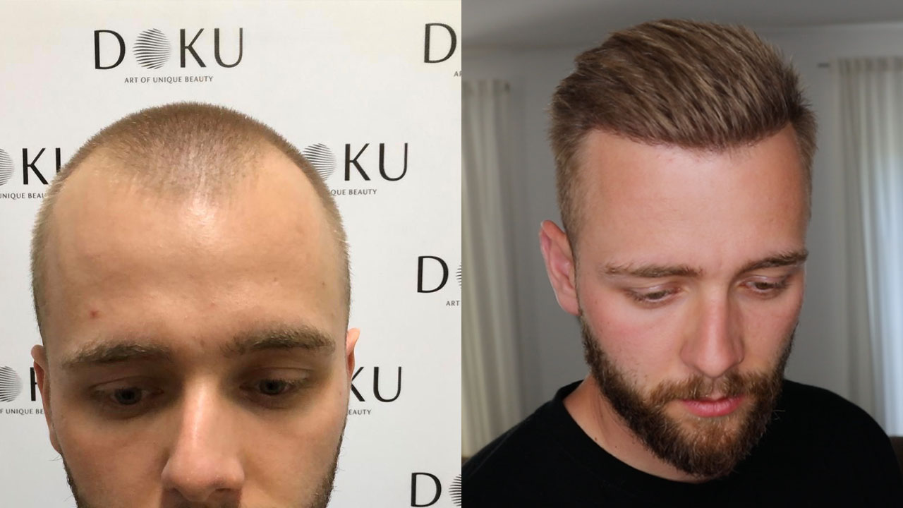 /foren/transplant/index.php/fa/47321/0/