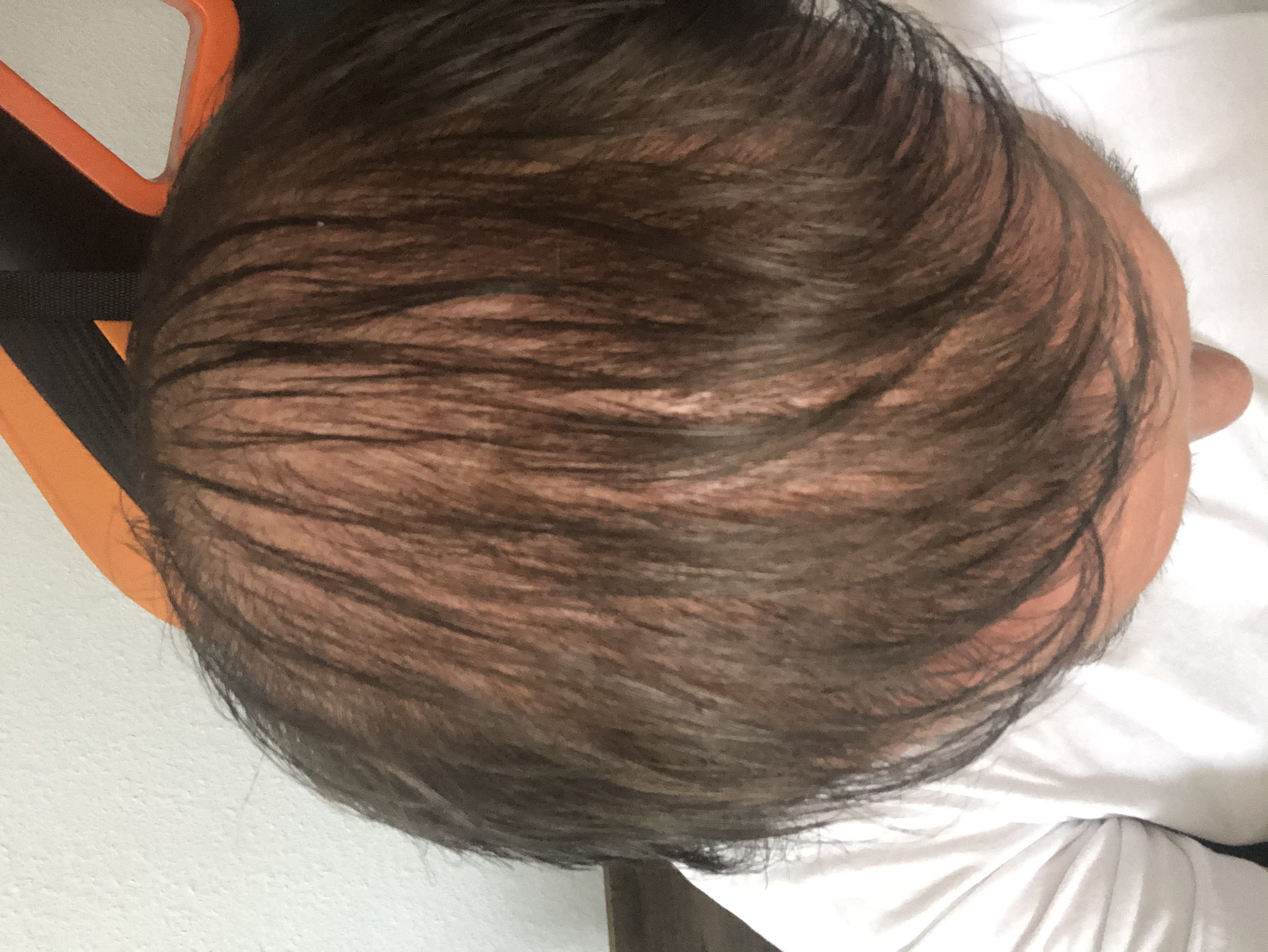 /foren/transplant/index.php/fa/47370/0/