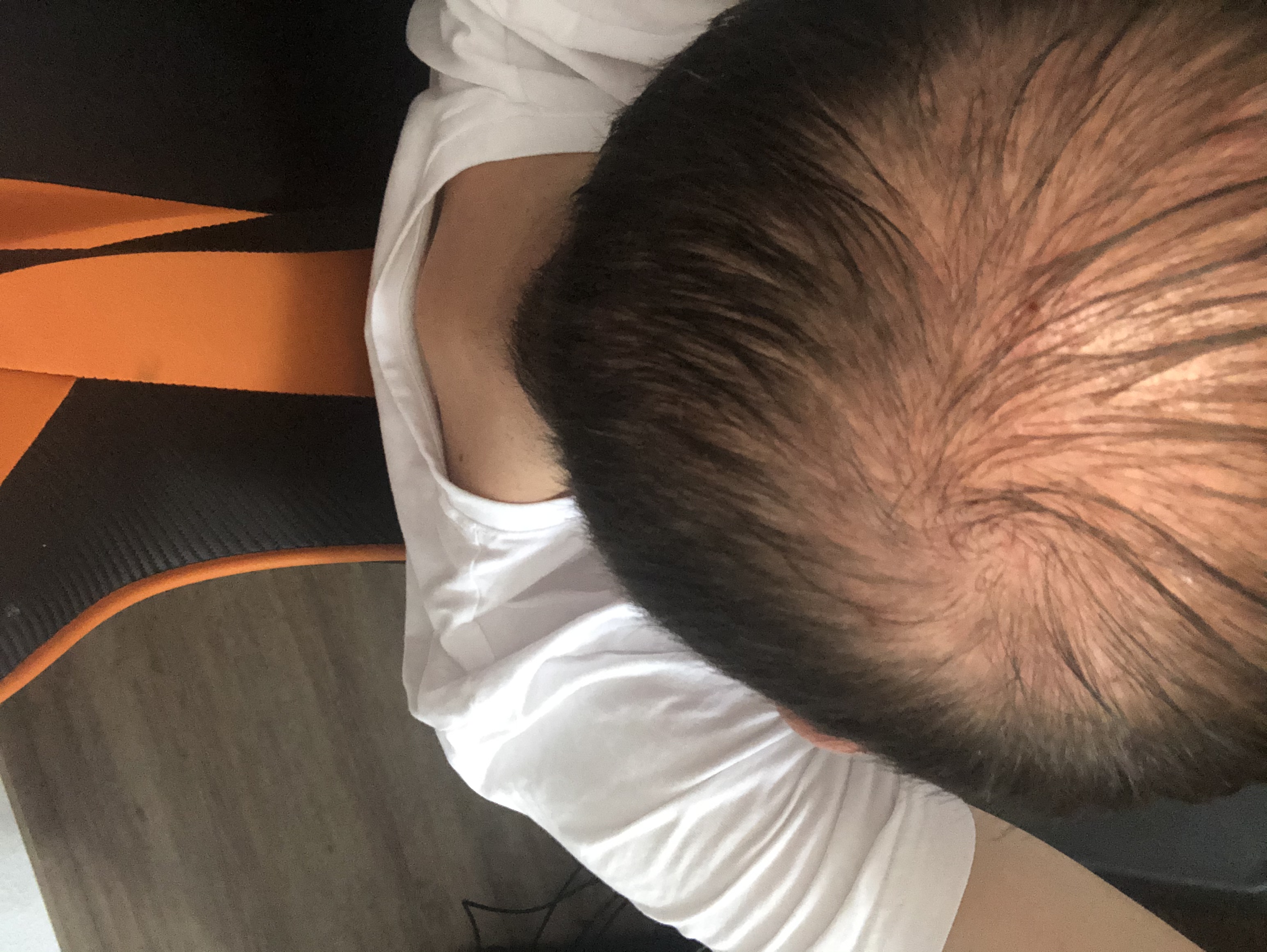 /foren/transplant/index.php/fa/47371/0/