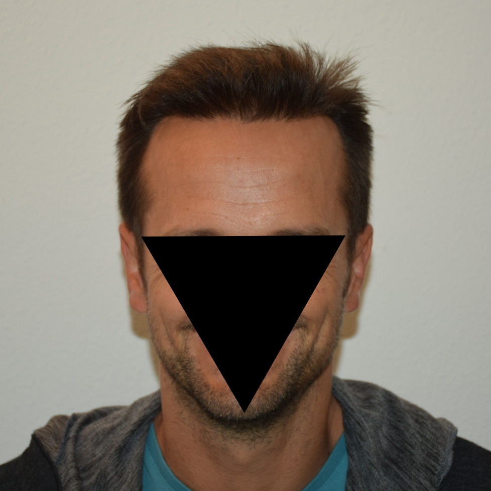 /foren/transplant/index.php/fa/47382/0/