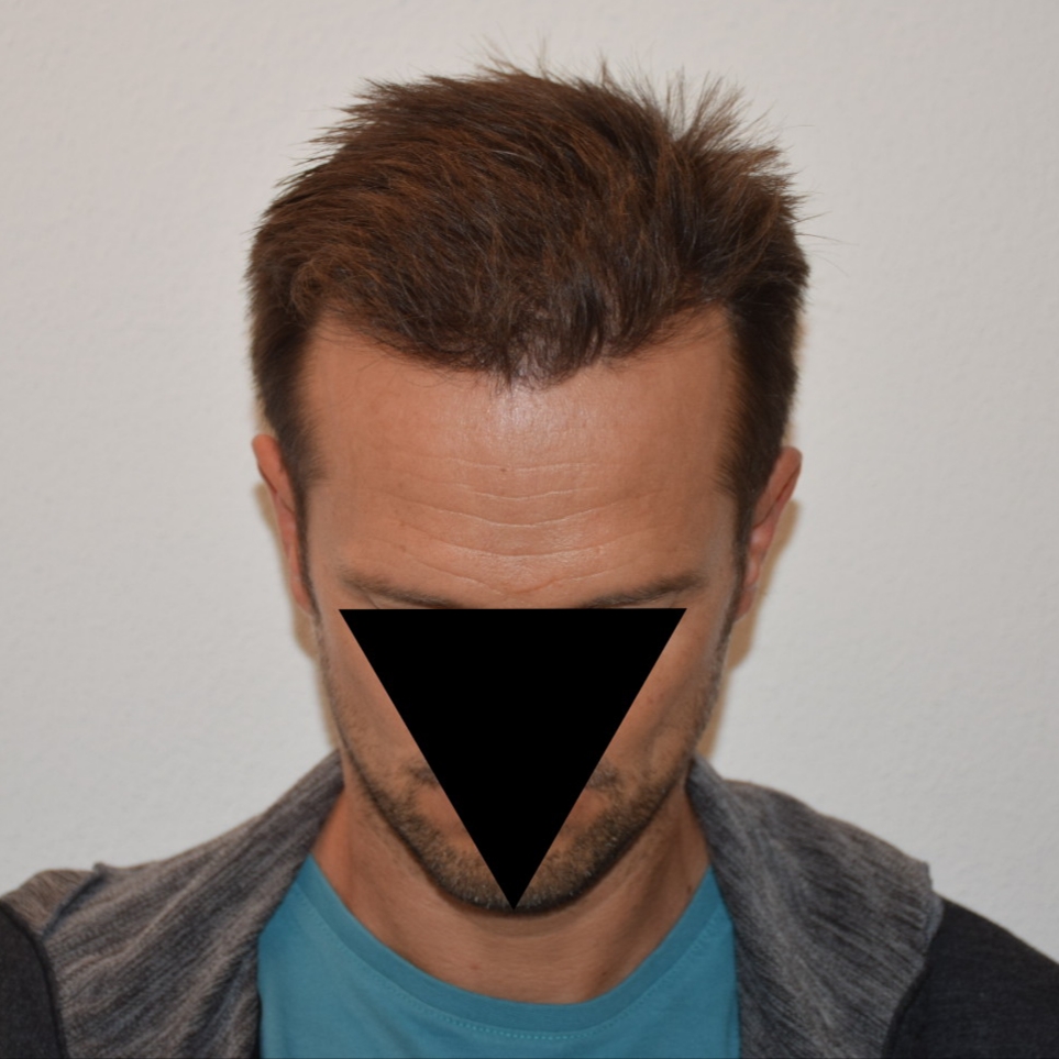 /foren/transplant/index.php/fa/47383/0/