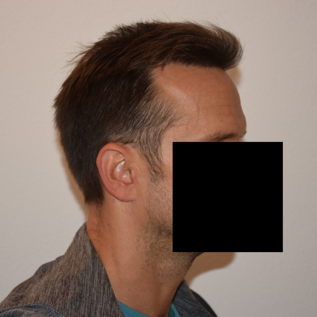 /foren/transplant/index.php/fa/47384/0/