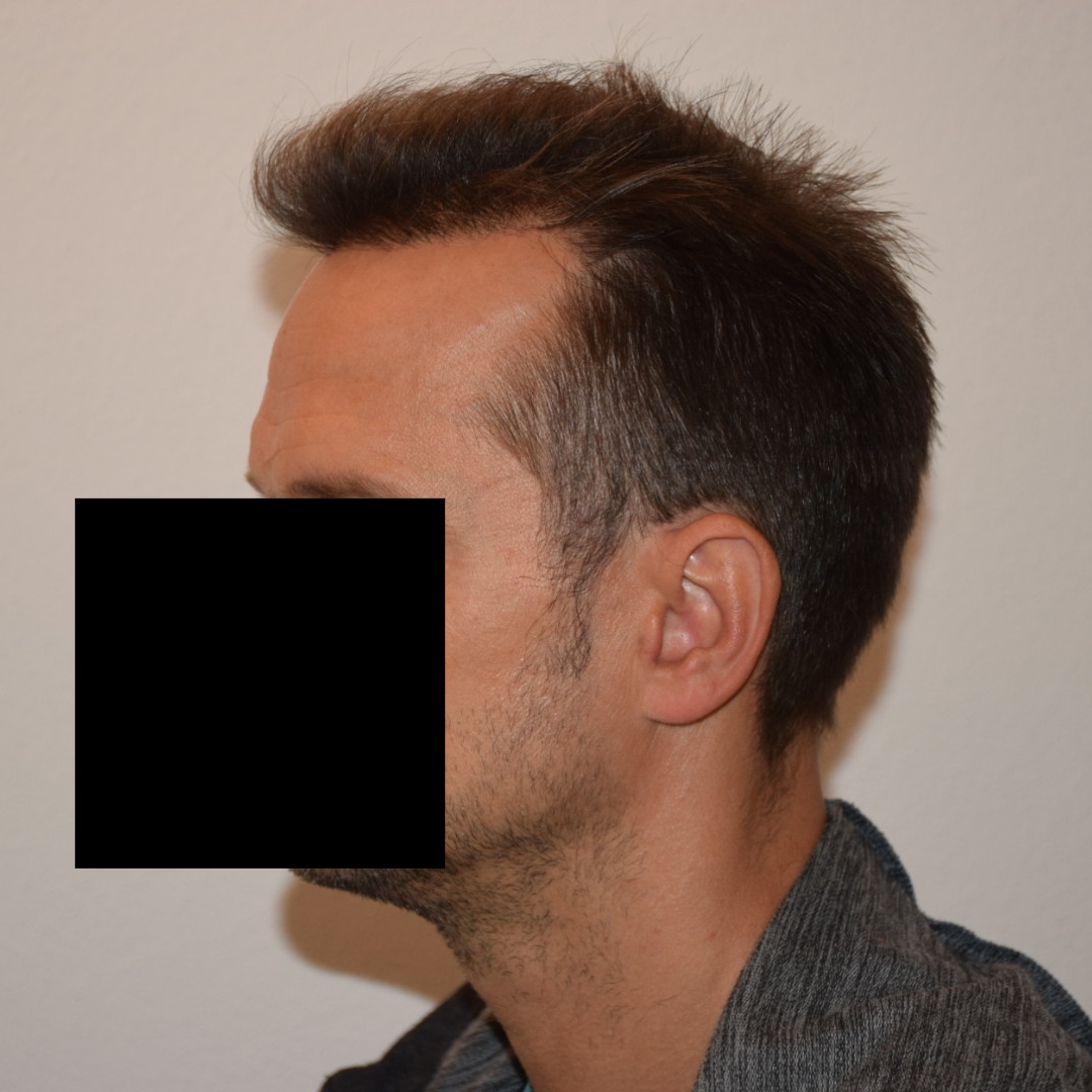 /foren/transplant/index.php/fa/47385/0/