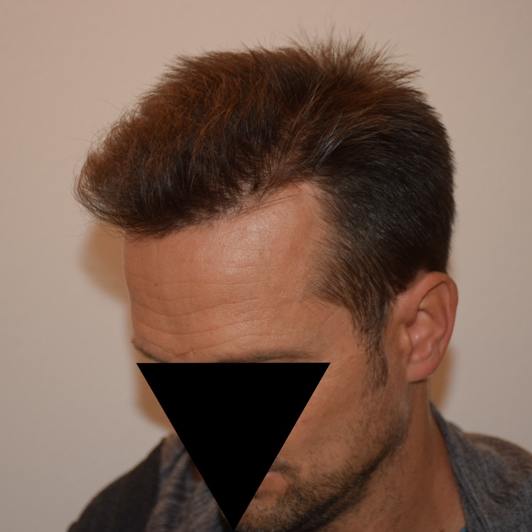 /foren/transplant/index.php/fa/47386/0/