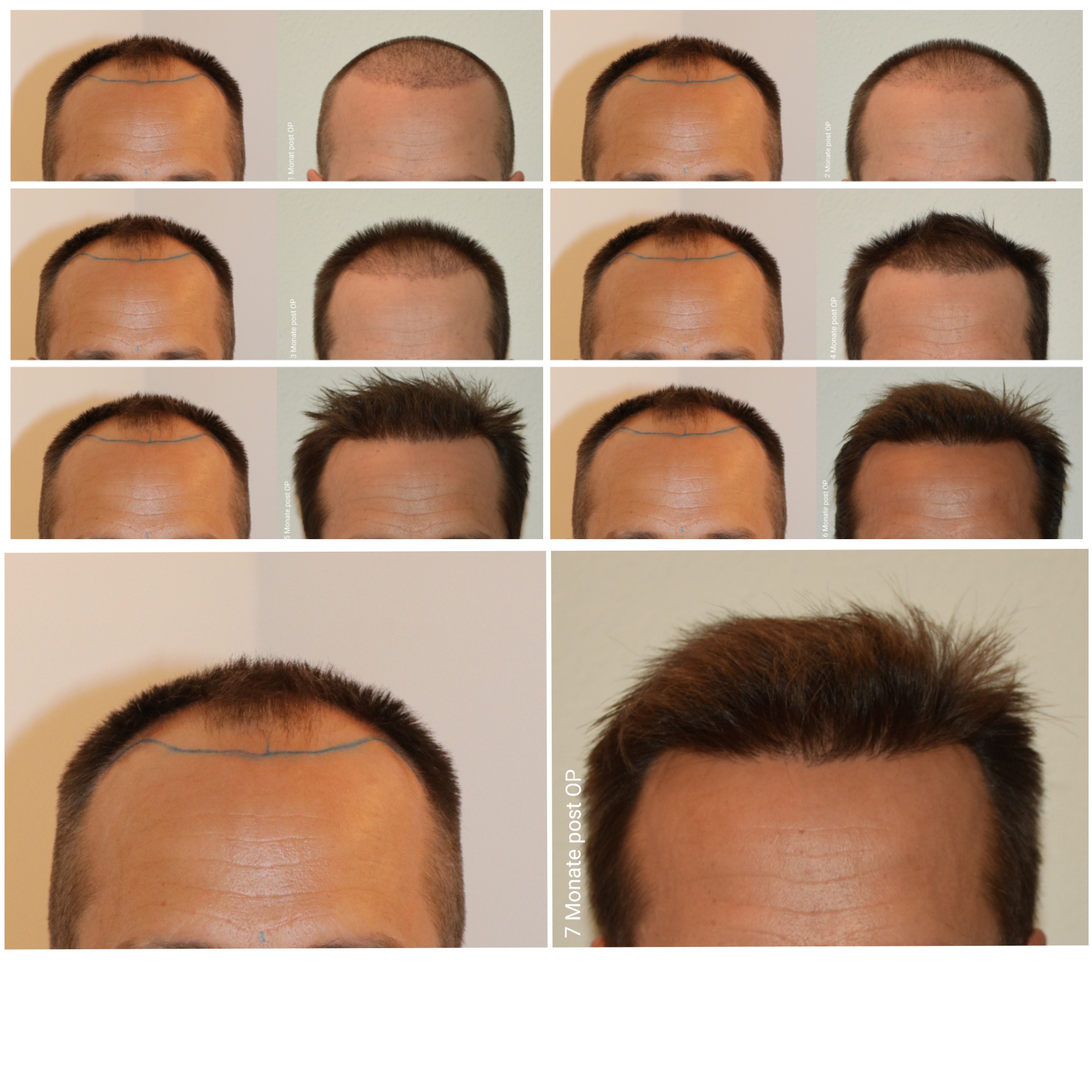 /foren/transplant/index.php/fa/47387/0/