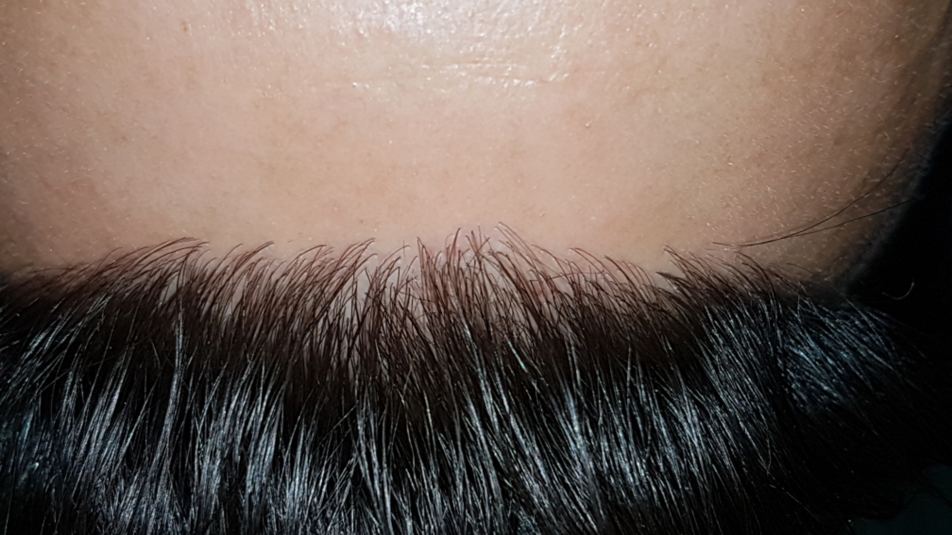 /foren/transplant/index.php/fa/47398/0/