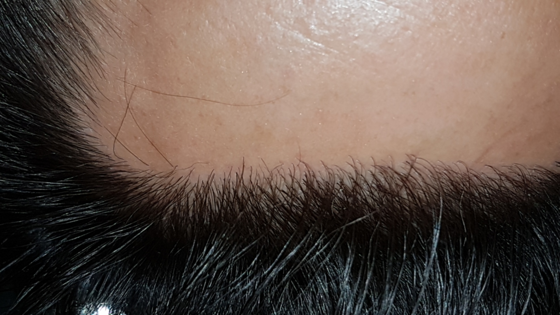 /foren/transplant/index.php/fa/47399/0/