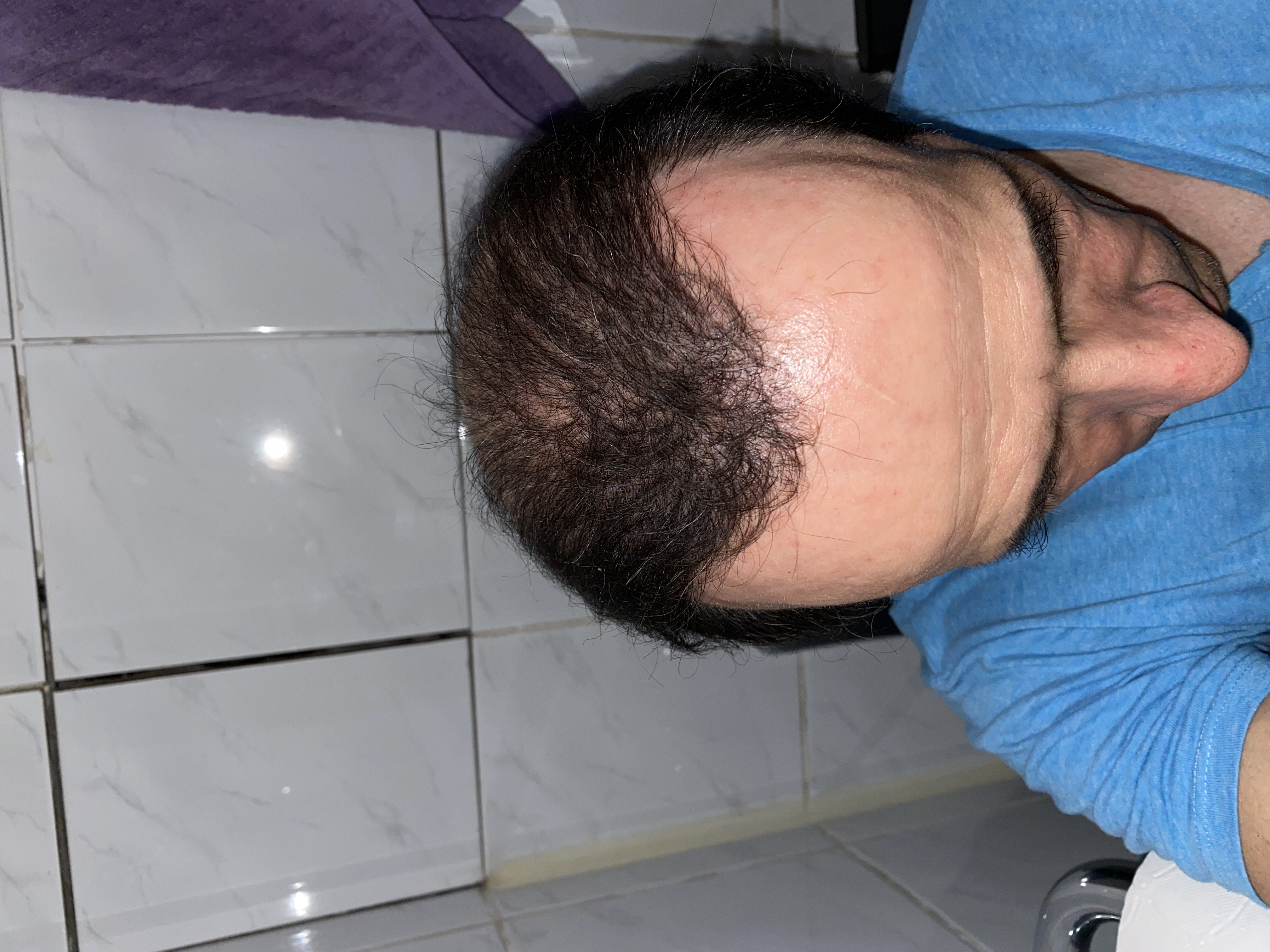 /foren/transplant/index.php/fa/47458/0/