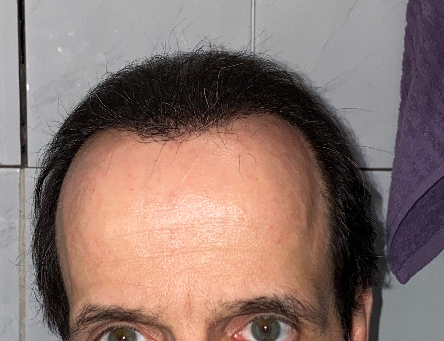 /foren/transplant/index.php/fa/47460/0/