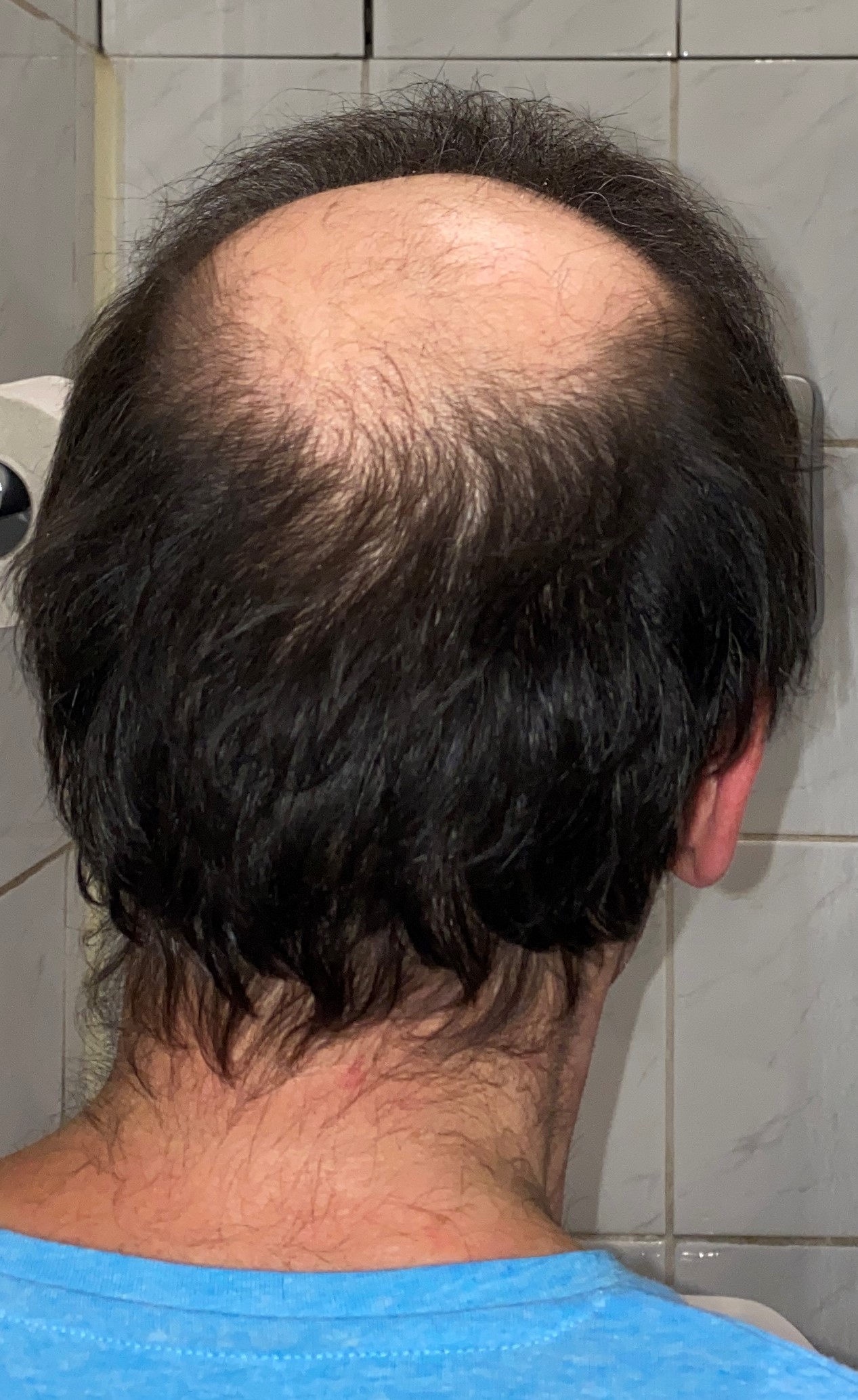 /foren/transplant/index.php/fa/47461/0/