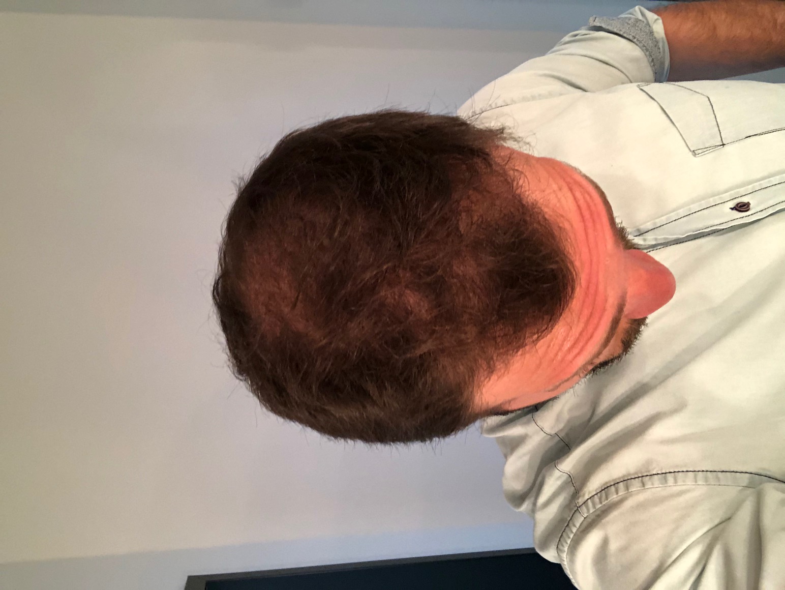 /foren/transplant/index.php/fa/47473/0/