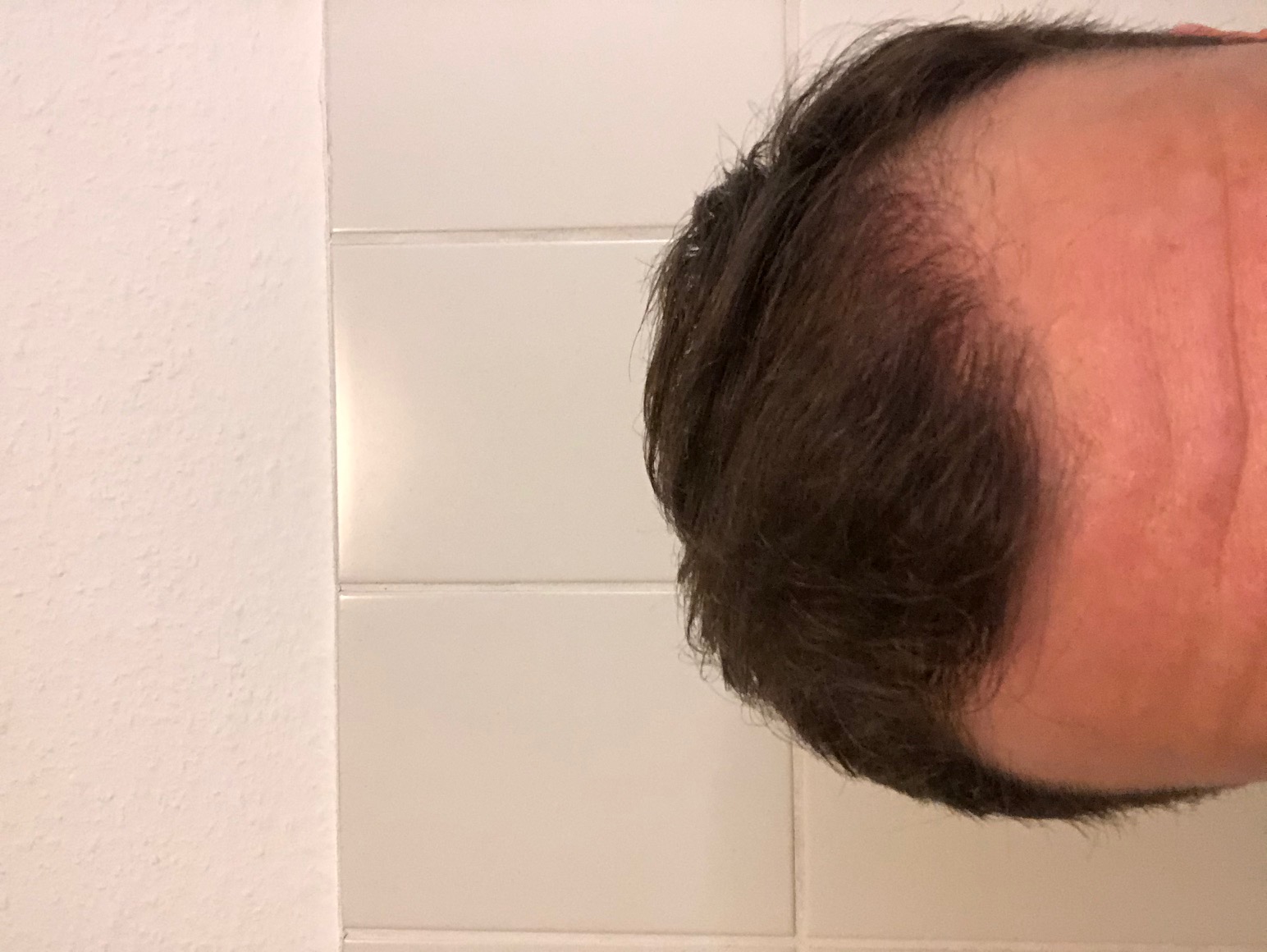 /foren/transplant/index.php/fa/47476/0/