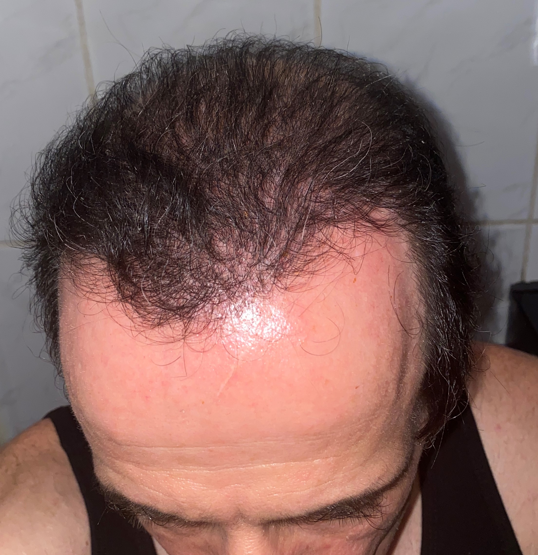 /foren/transplant/index.php/fa/47677/0/