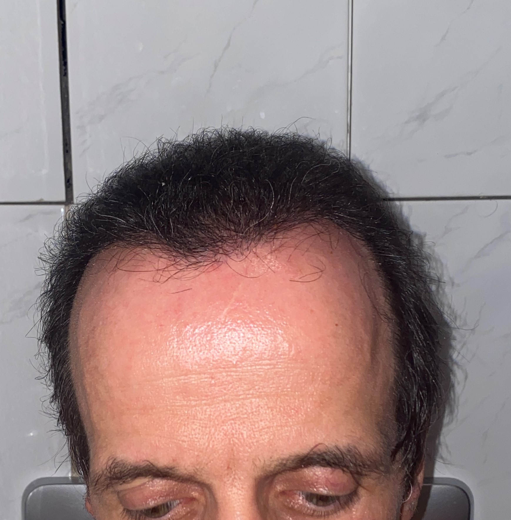 /foren/transplant/index.php/fa/47679/0/