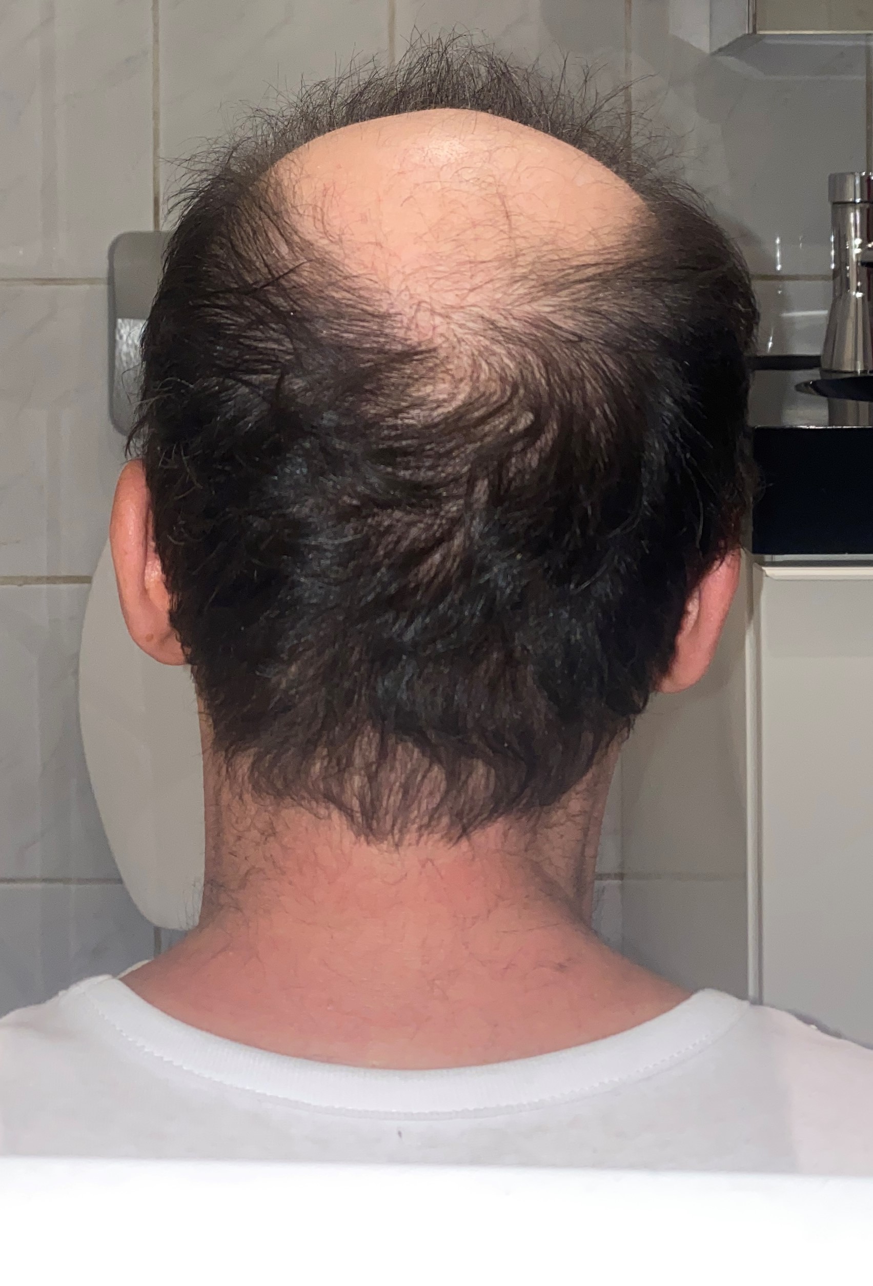 /foren/transplant/index.php/fa/47680/0/