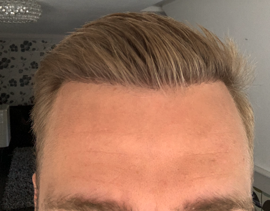 /foren/transplant/index.php/fa/47718/0/