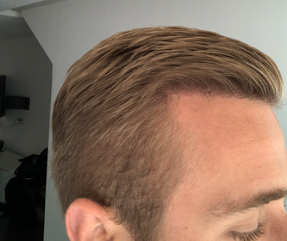 /foren/transplant/index.php/fa/47719/0/