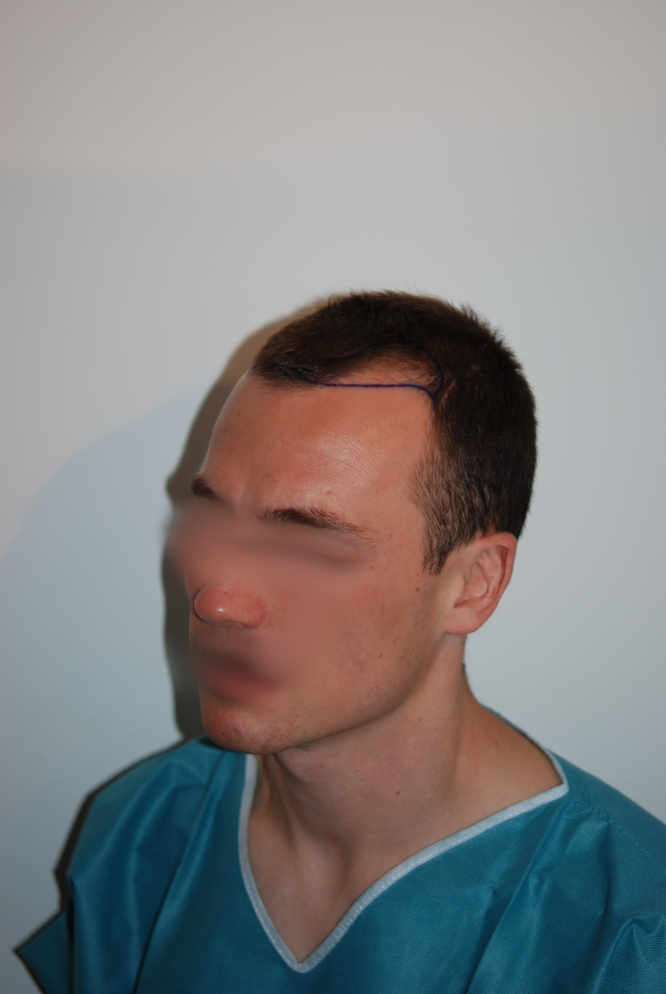 /foren/transplant/index.php/fa/47751/0/