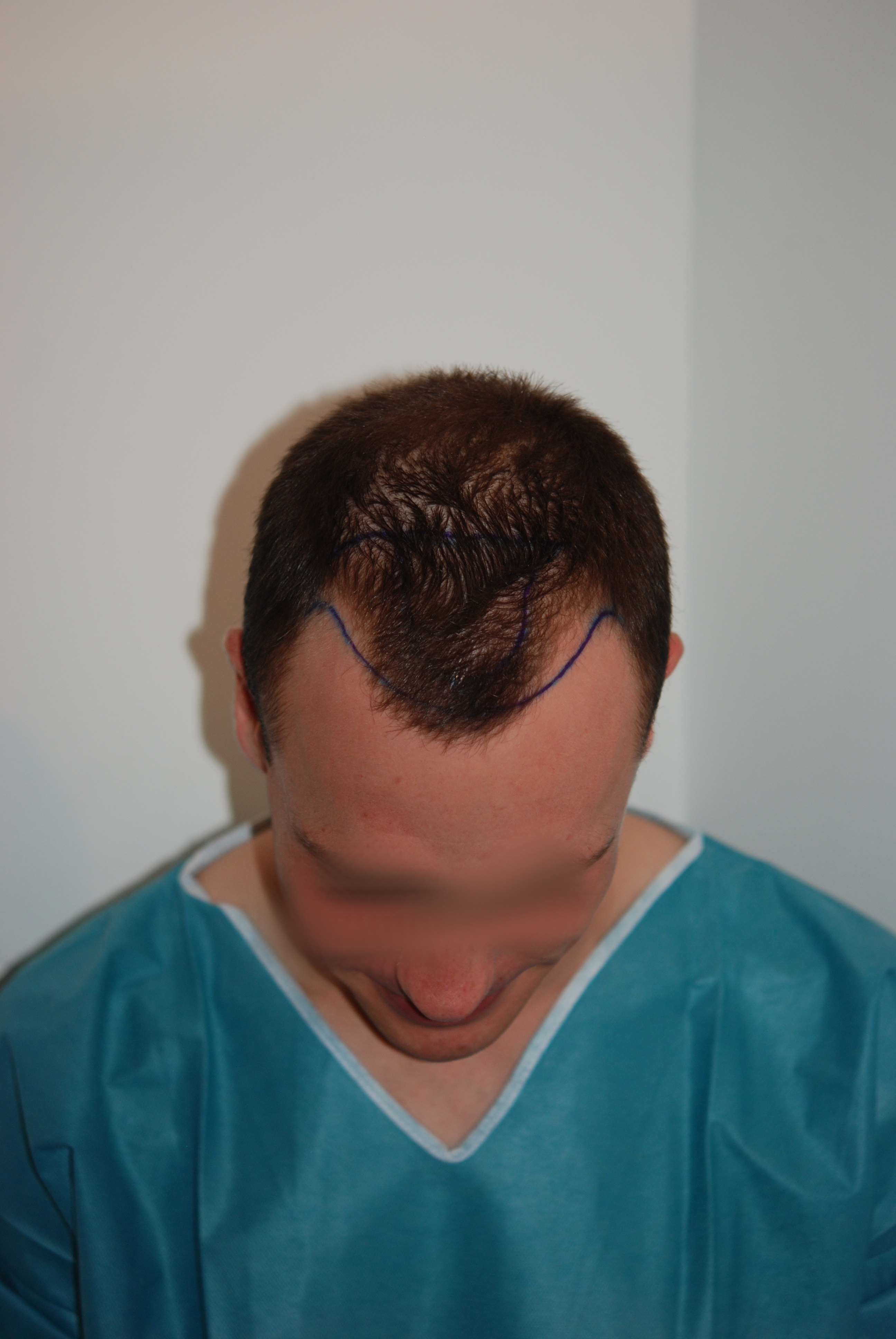 /foren/transplant/index.php/fa/47752/0/