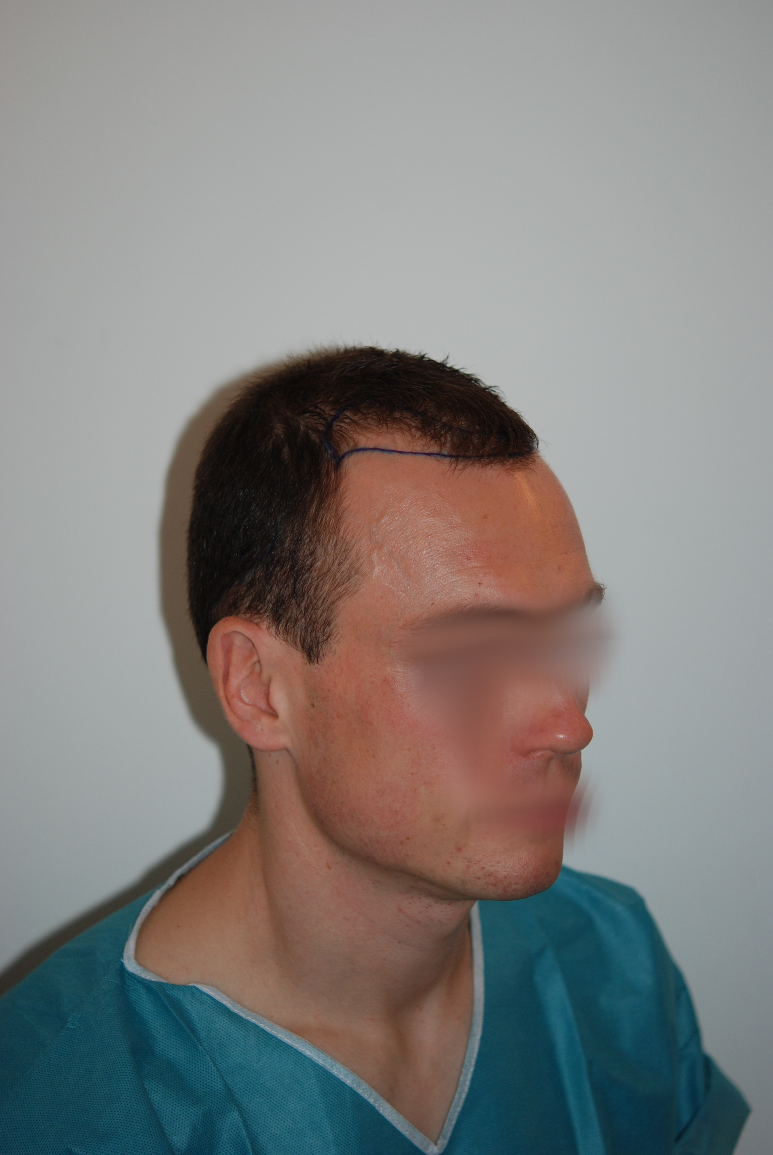 /foren/transplant/index.php/fa/47753/0/