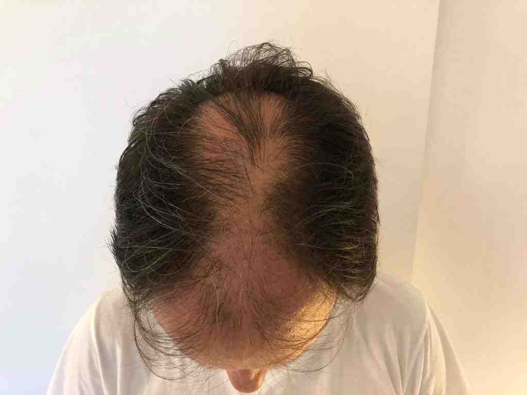 /foren/transplant/index.php/fa/47915/0/