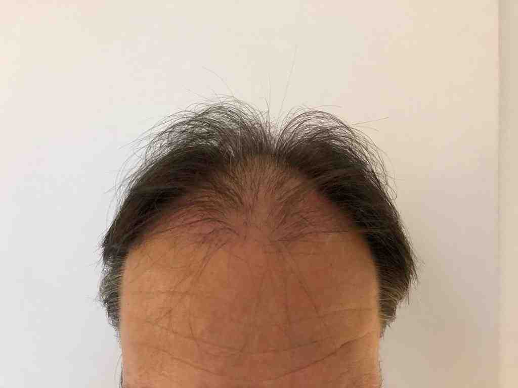 /foren/transplant/index.php/fa/47916/0/