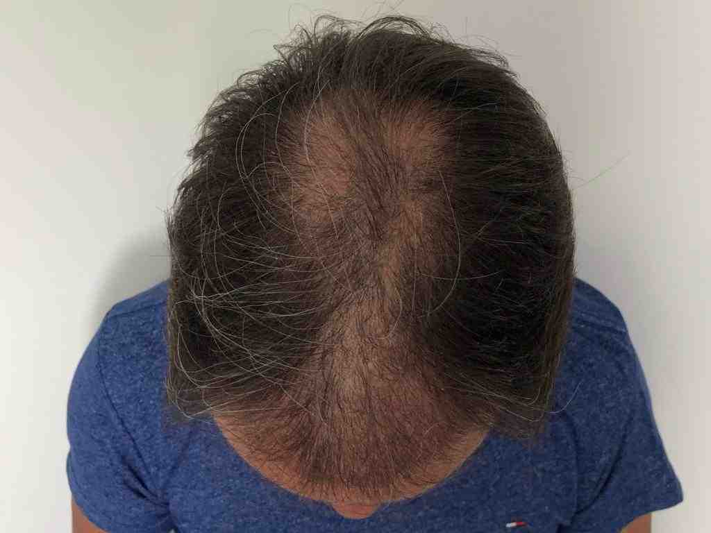 /foren/transplant/index.php/fa/47917/0/