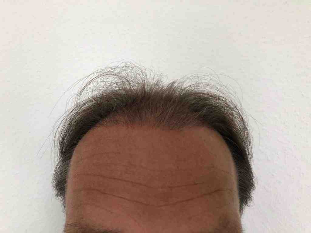 /foren/transplant/index.php/fa/47918/0/