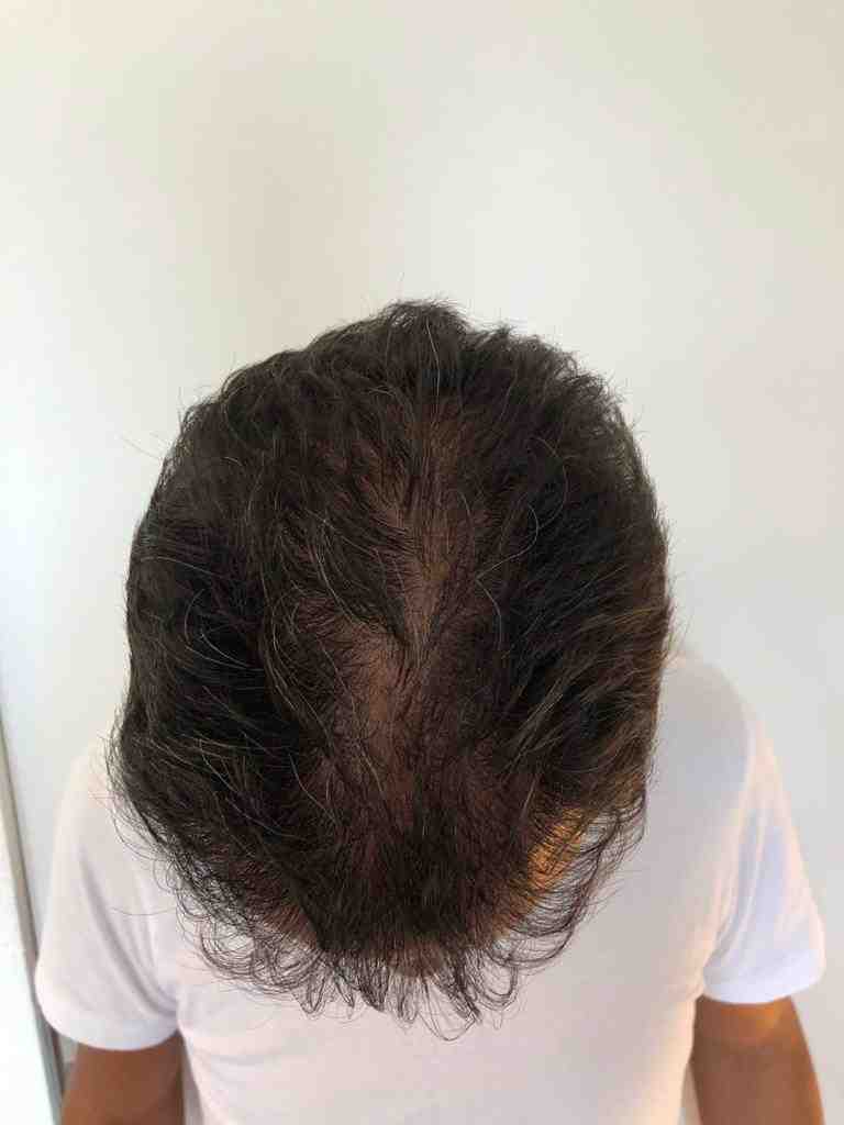 /foren/transplant/index.php/fa/47919/0/