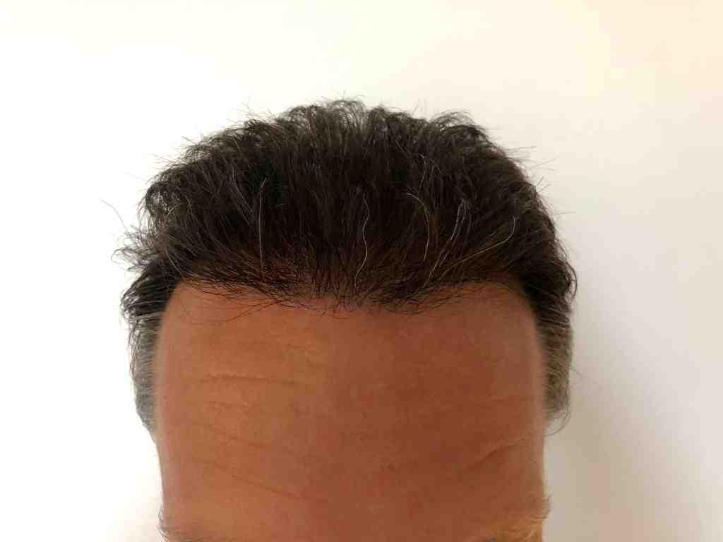 /foren/transplant/index.php/fa/47920/0/