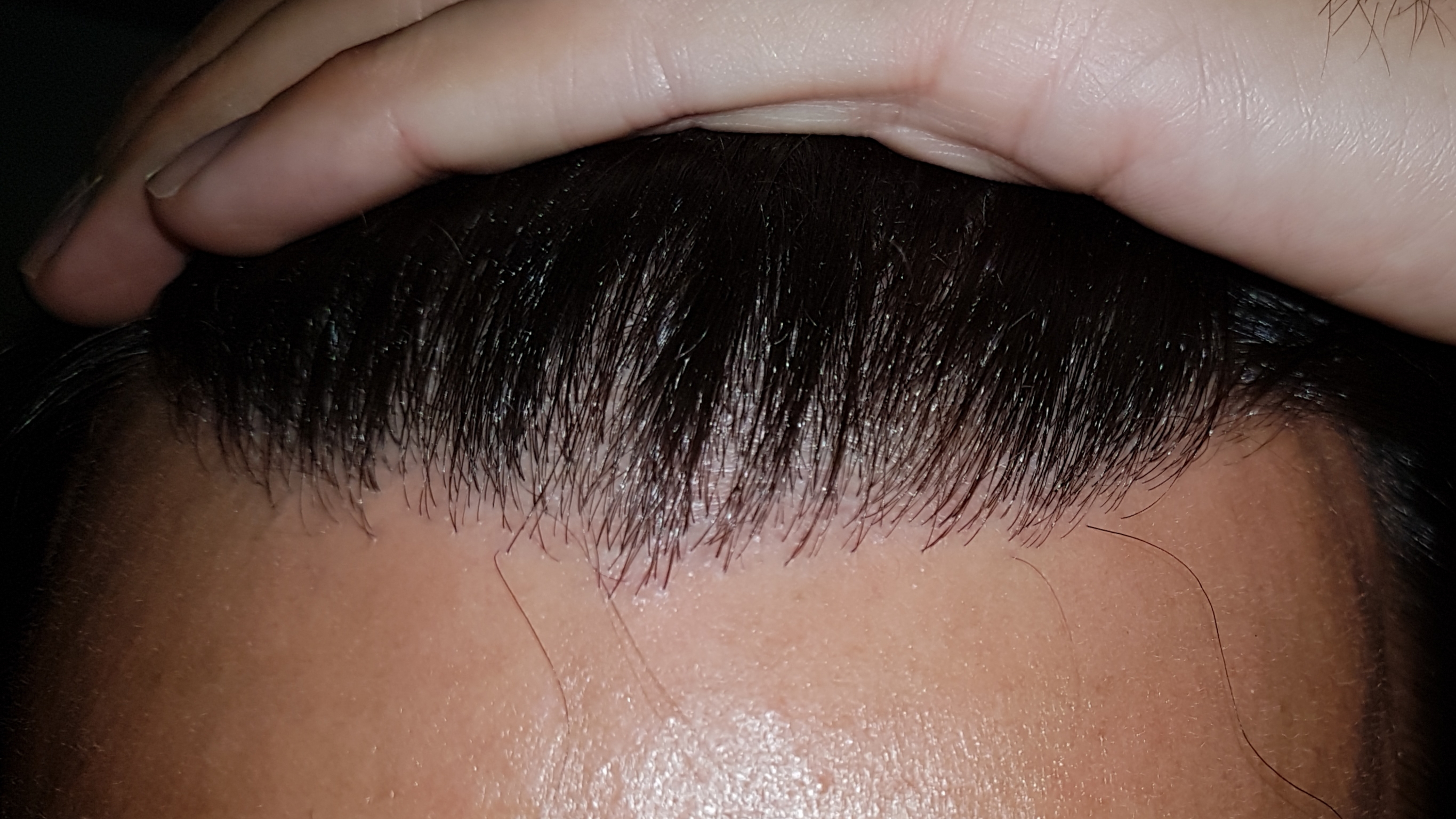 /foren/transplant/index.php/fa/47937/0/