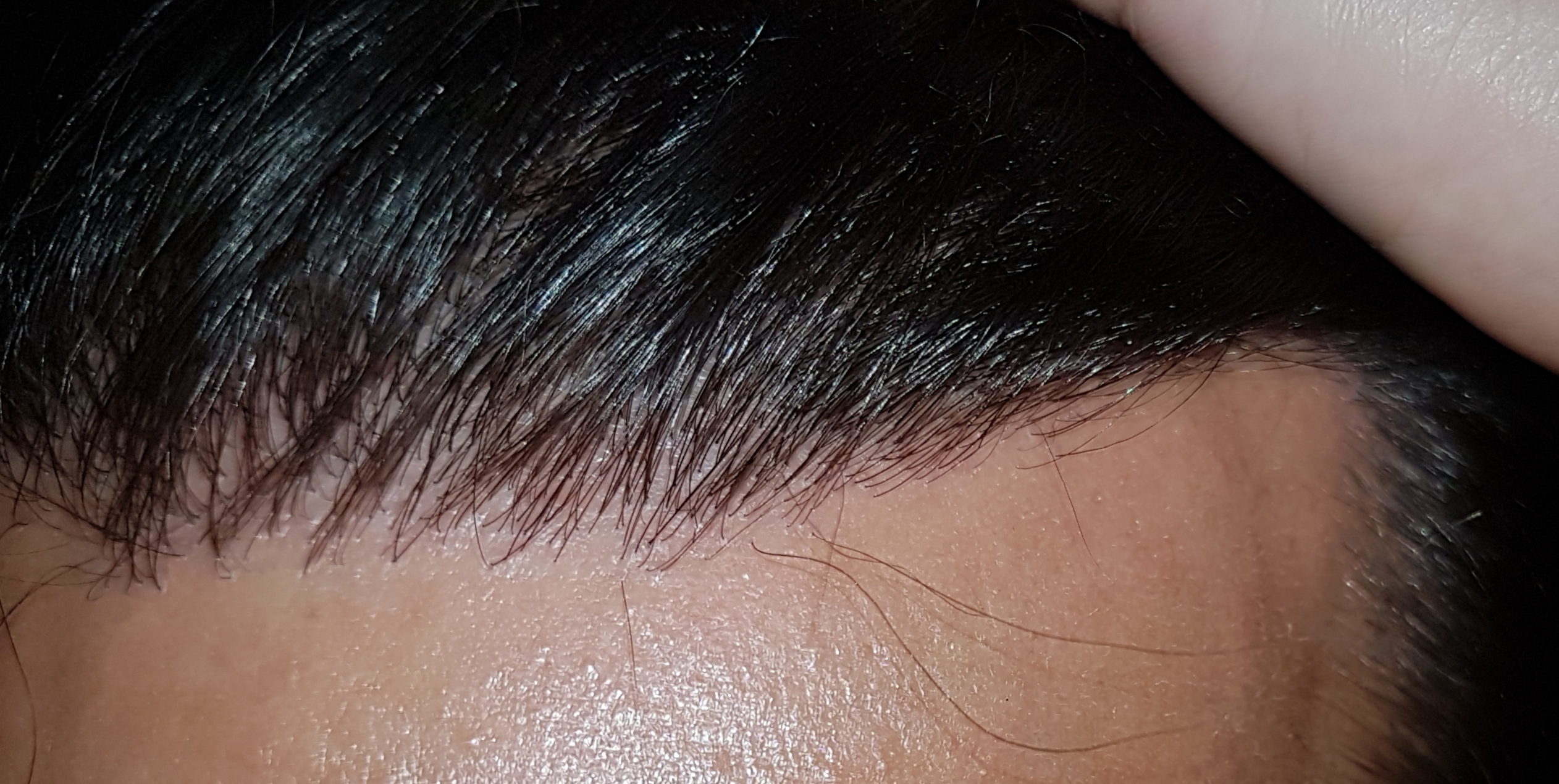 /foren/transplant/index.php/fa/47938/0/