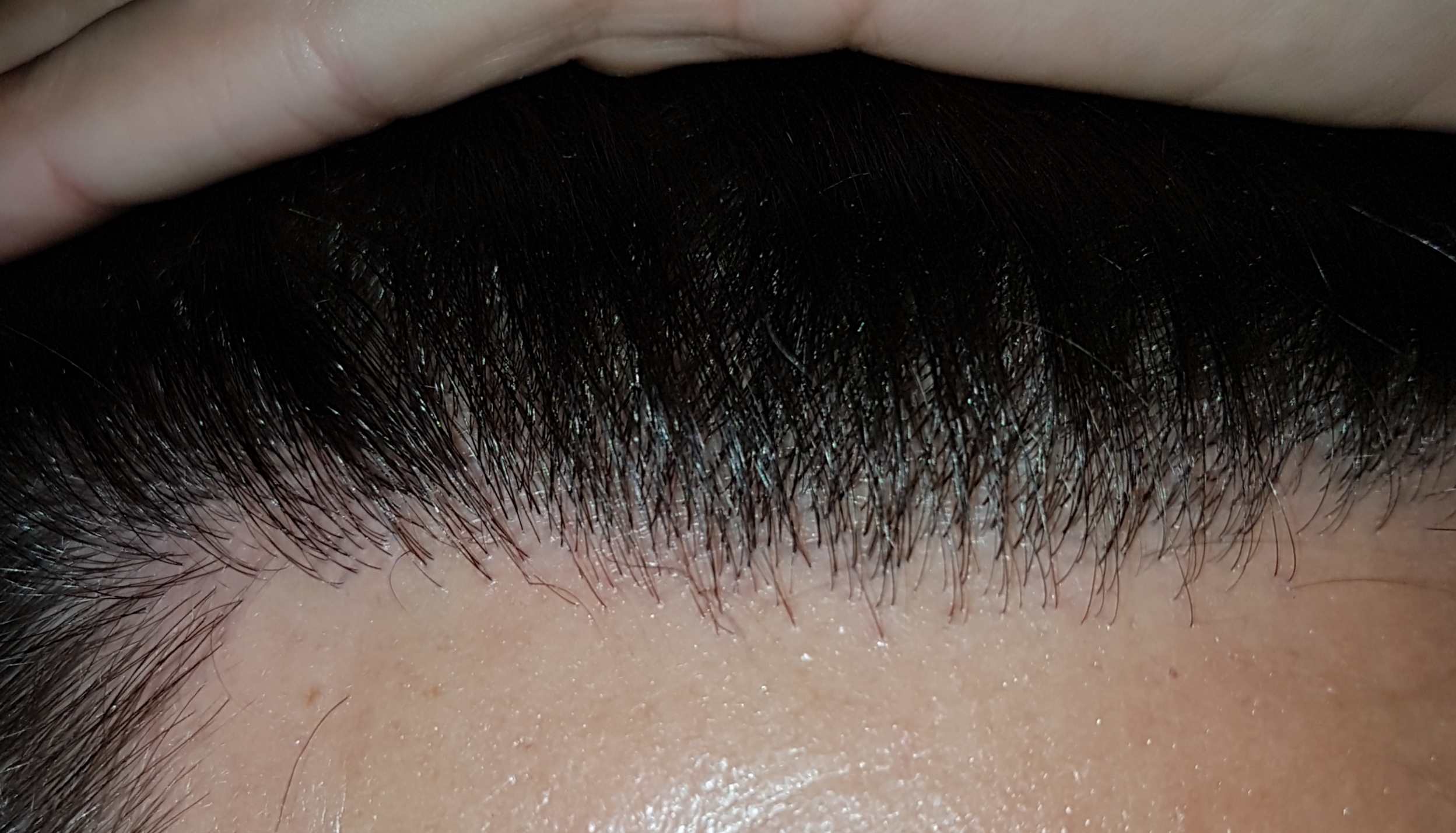 /foren/transplant/index.php/fa/47939/0/