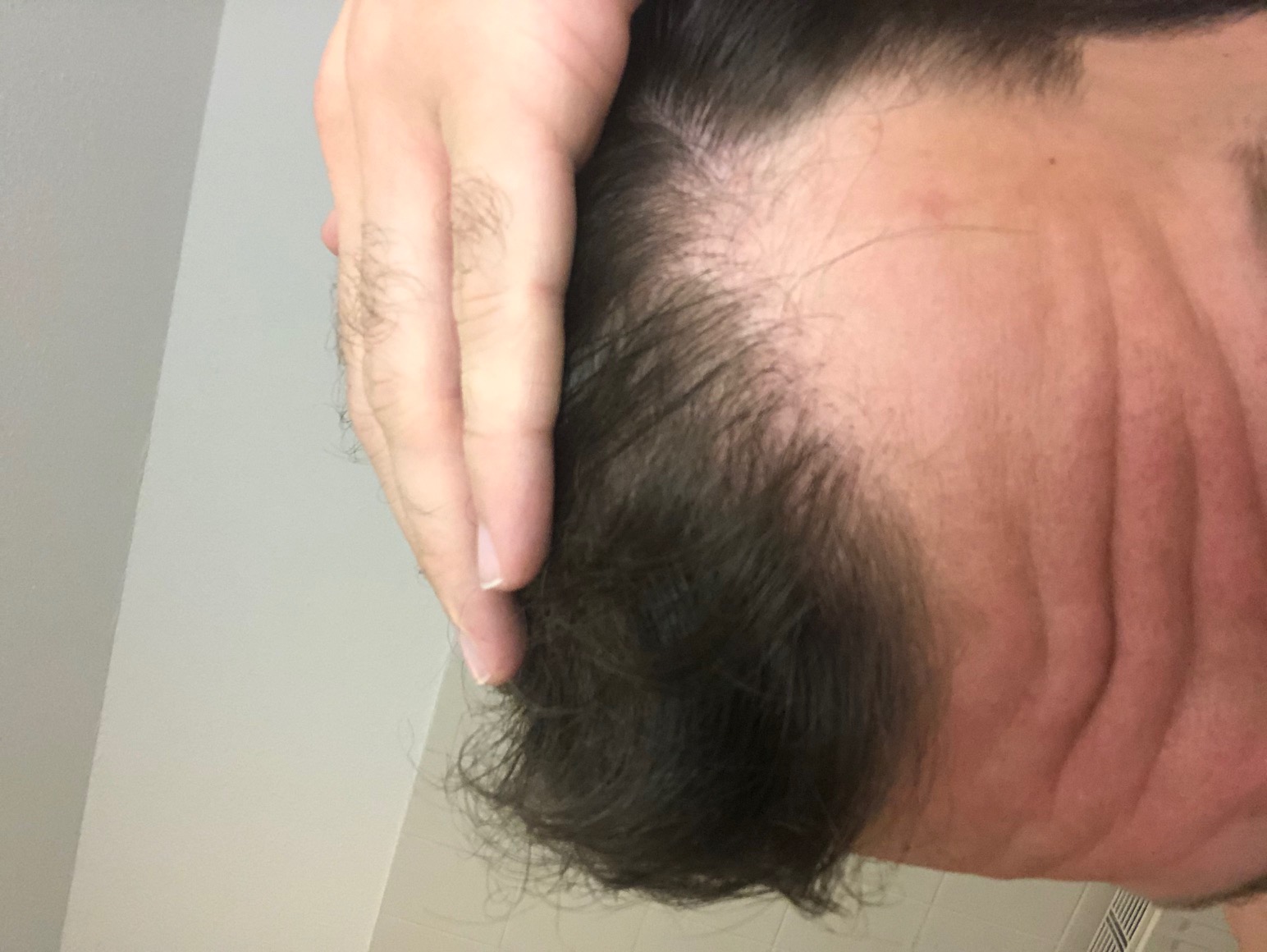 /foren/transplant/index.php/fa/47942/0/