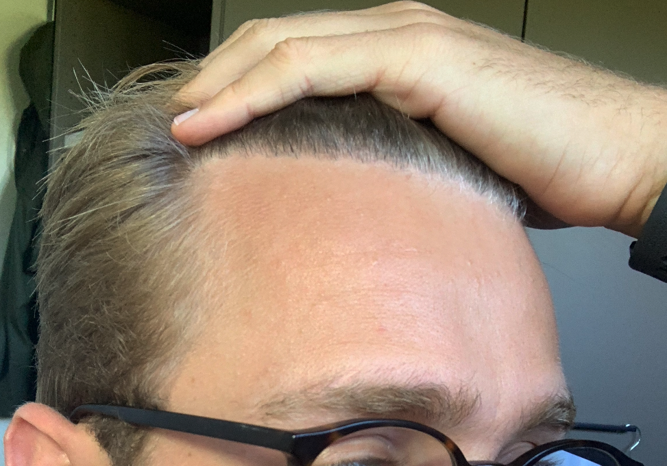 /foren/transplant/index.php/fa/47963/0/