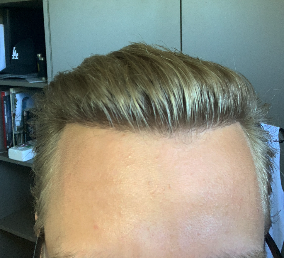 /foren/transplant/index.php/fa/47965/0/