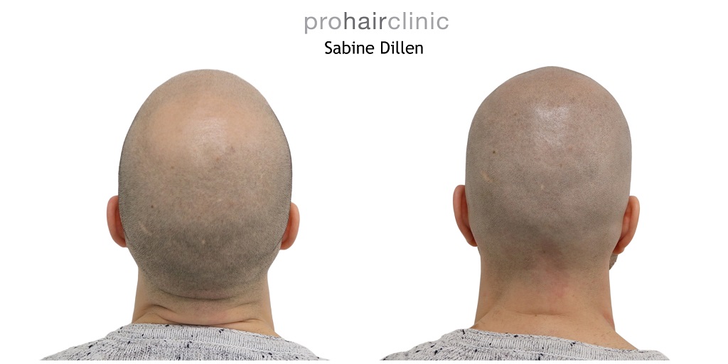 /foren/transplant/index.php/fa/47967/0/