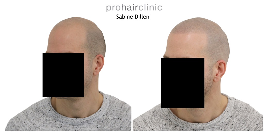 /foren/transplant/index.php/fa/47968/0/