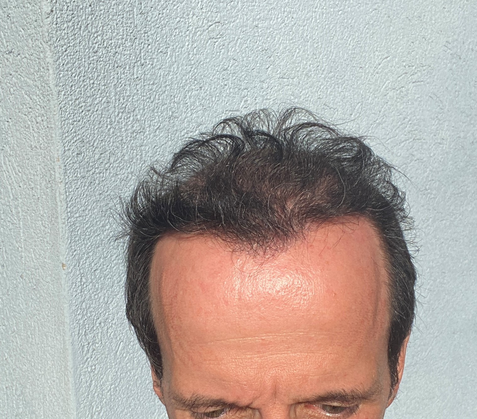 /foren/transplant/index.php/fa/47976/0/