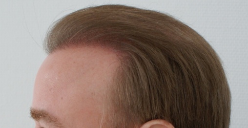 index.php/fa/4799/0/