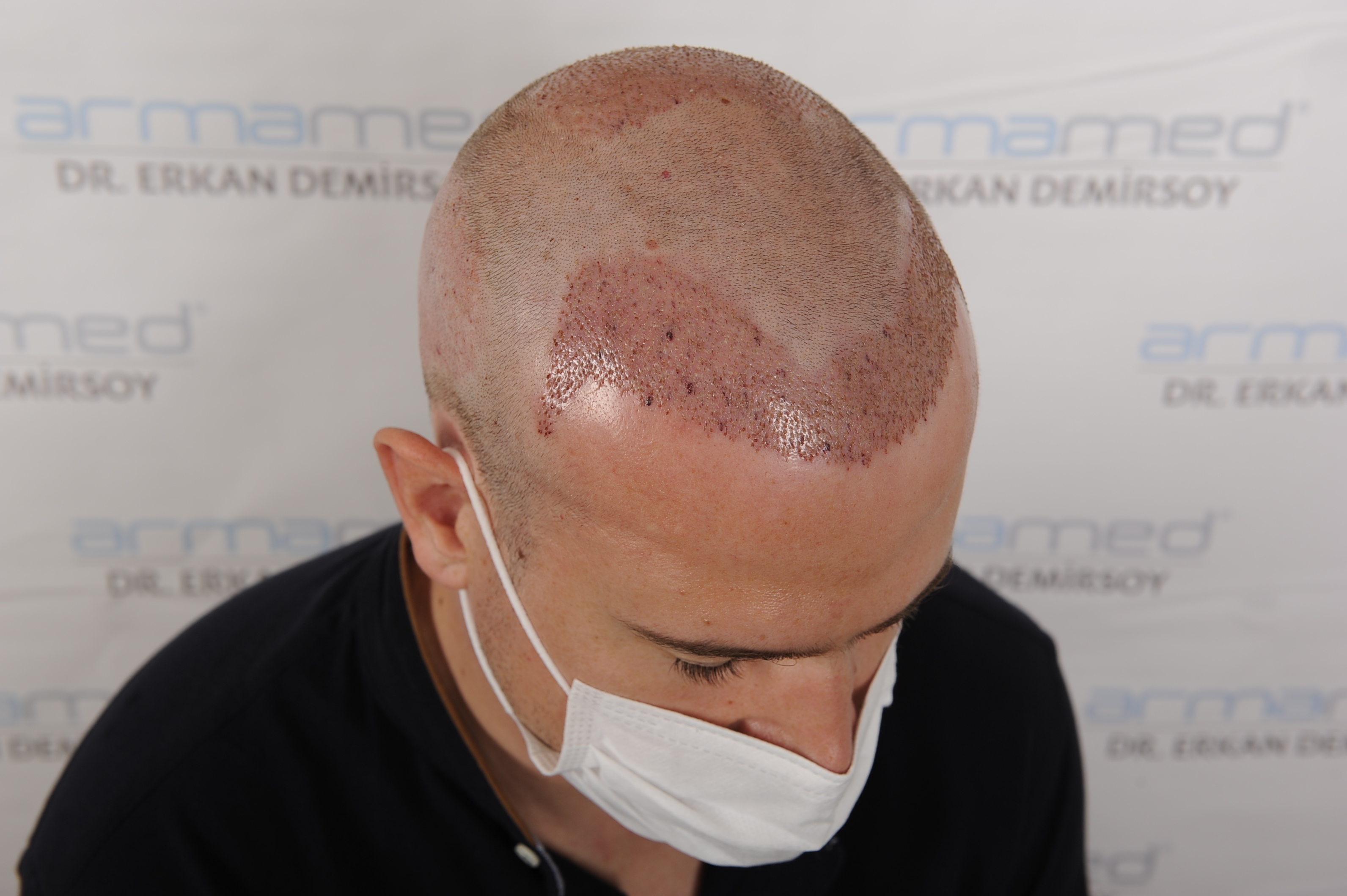 /foren/transplant/index.php/fa/48016/0/