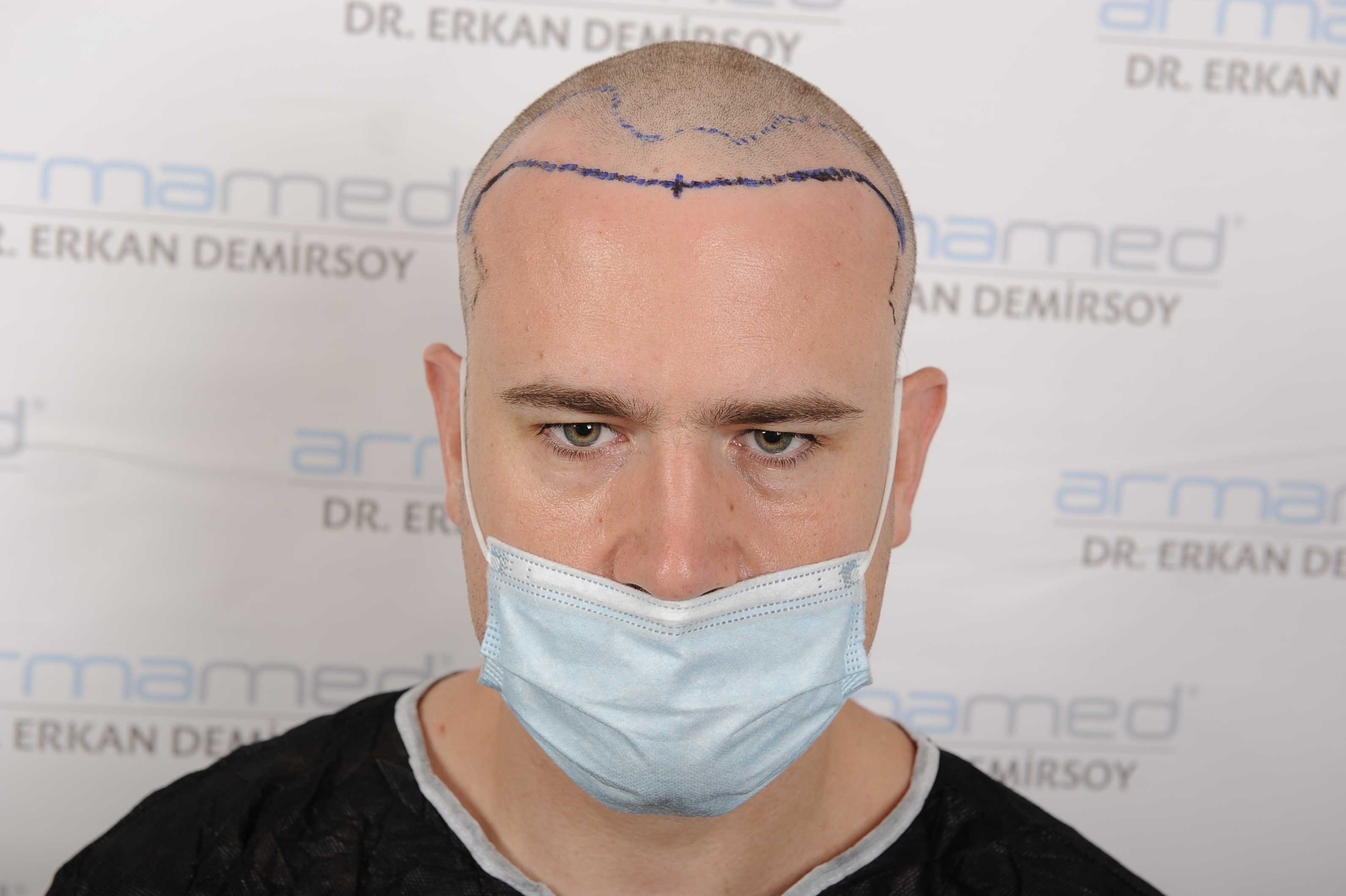 /foren/transplant/index.php/fa/48019/0/