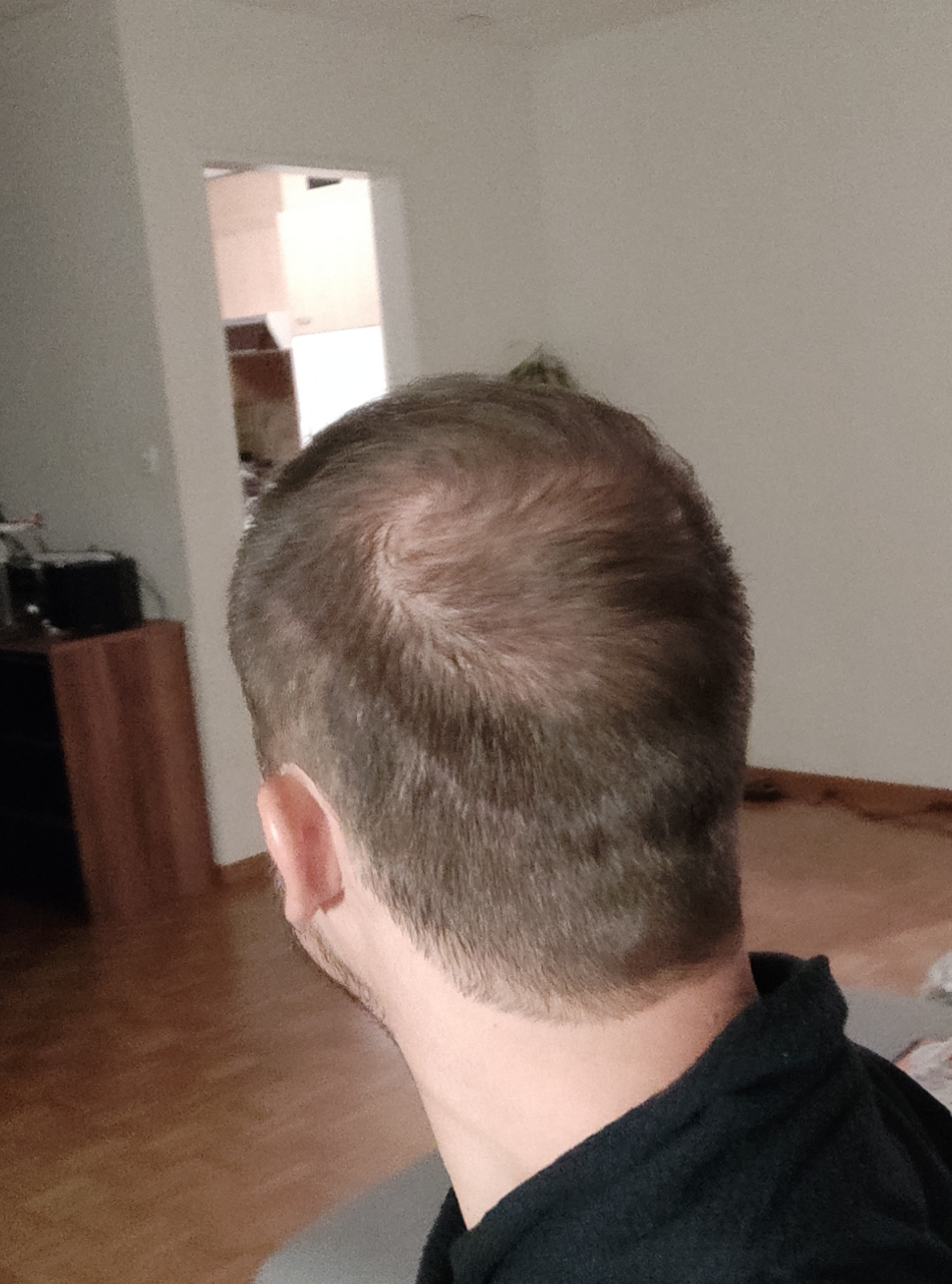 /foren/transplant/index.php/fa/48034/0/