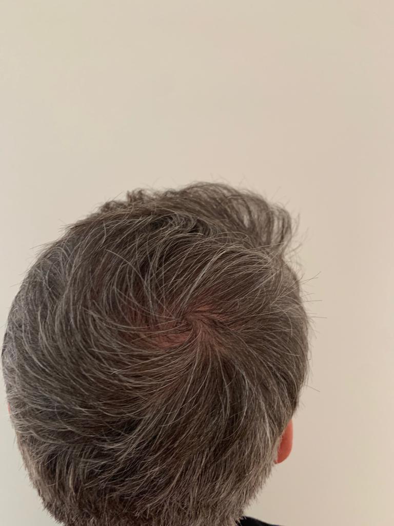 /foren/transplant/index.php/fa/48052/0/