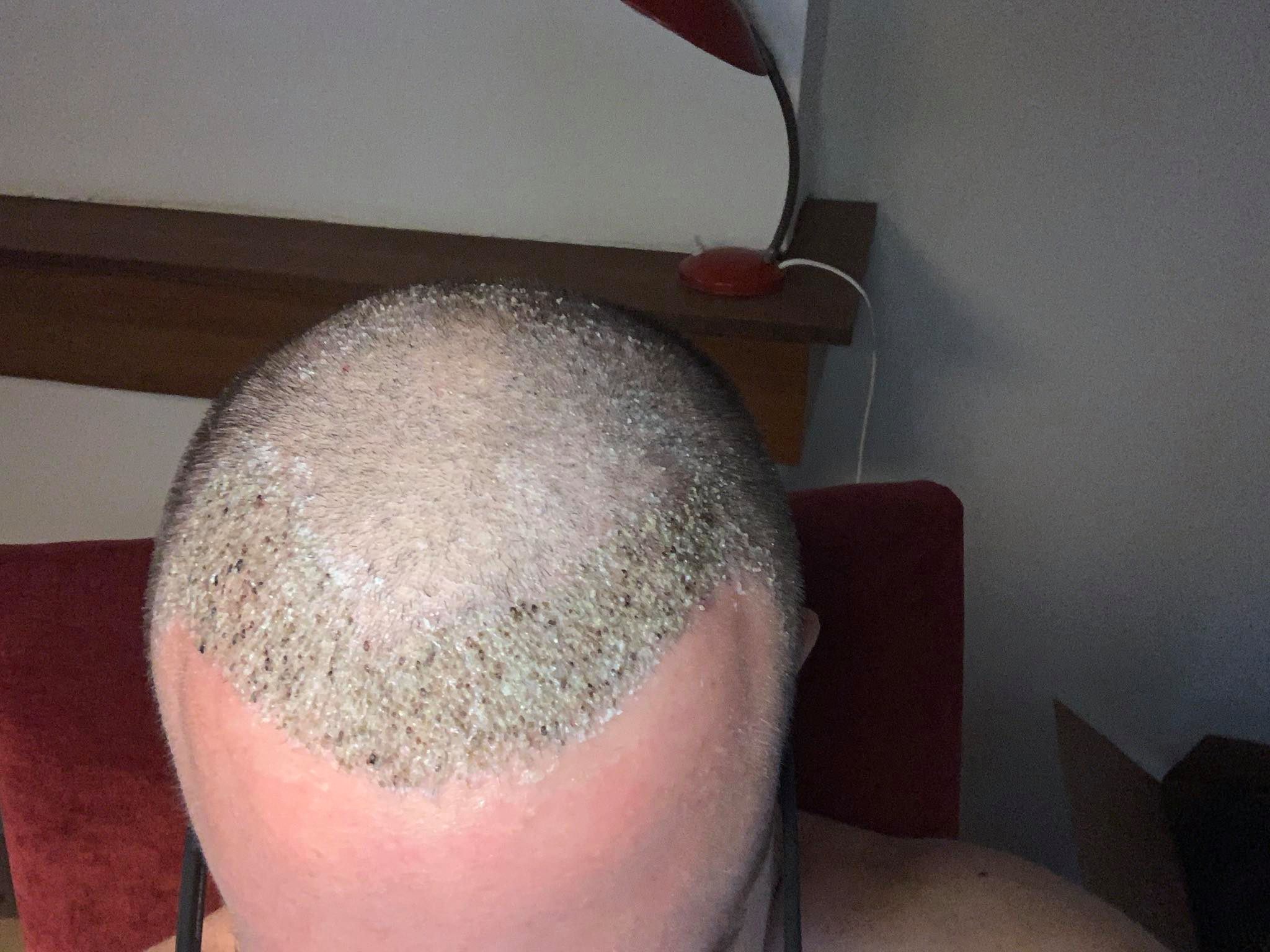 /foren/transplant/index.php/fa/48090/0/