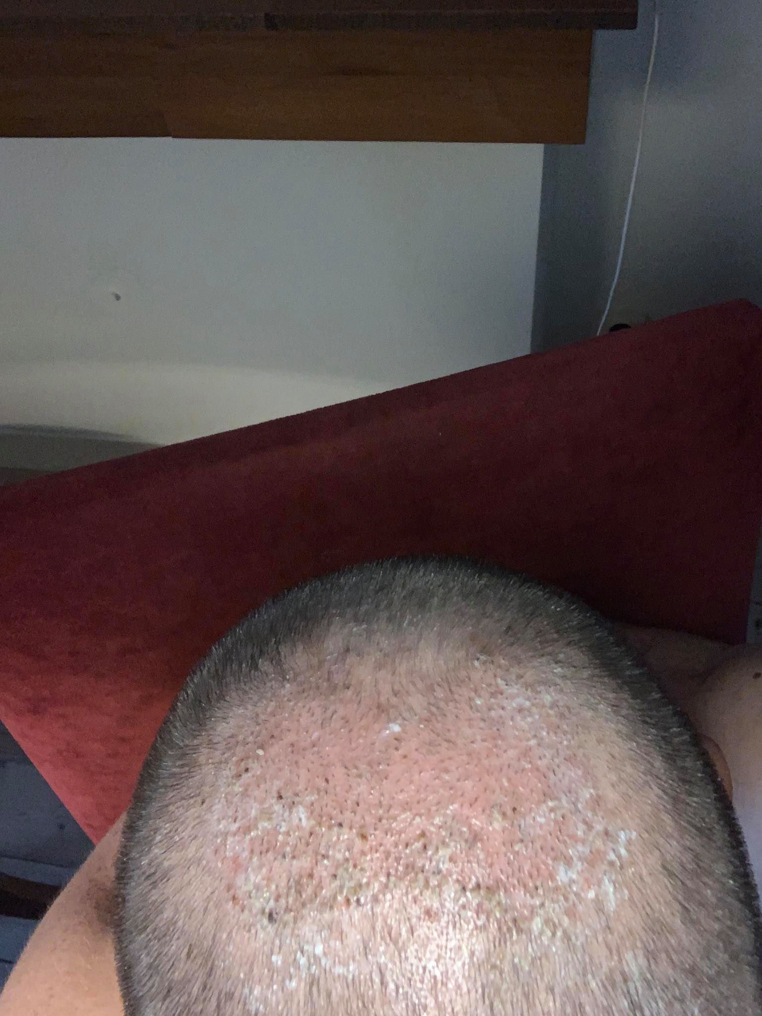 /foren/transplant/index.php/fa/48091/0/