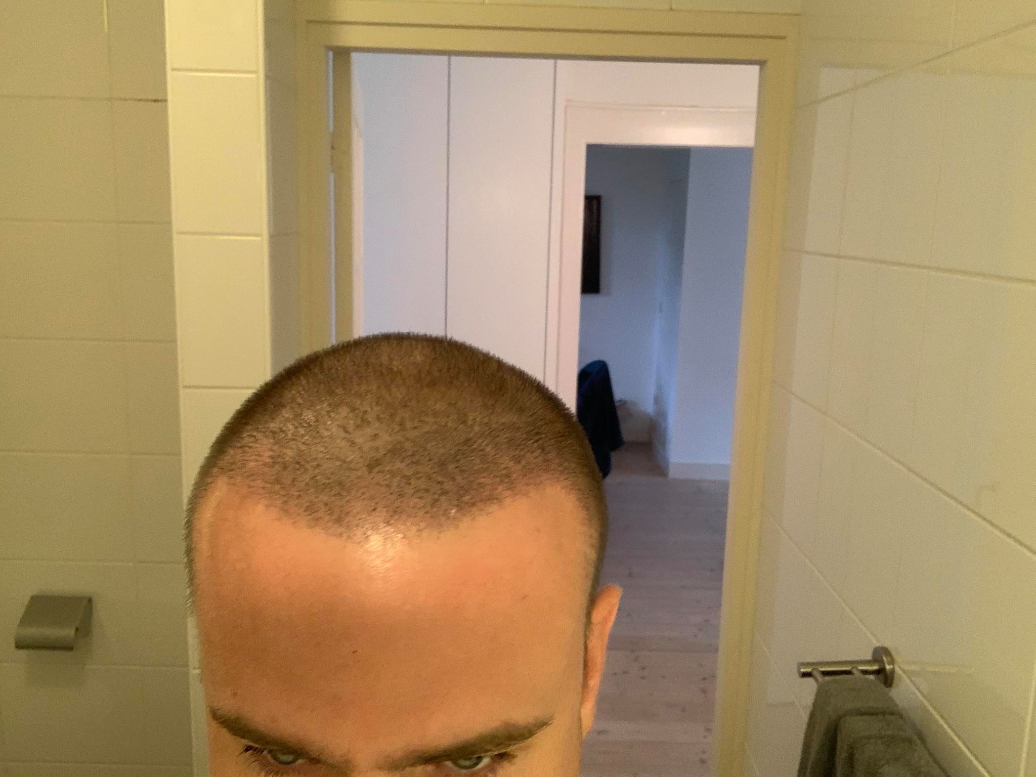 /foren/transplant/index.php/fa/48137/0/